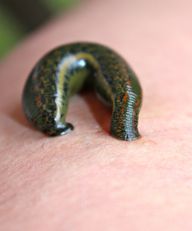 Leeches during leech therapy.